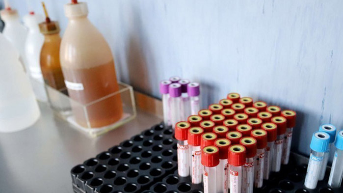 Затвориха детска градина в Разлог, учителка с COVID-19